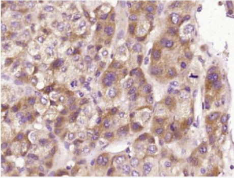 Anti-IFIT1 antibody-干扰素诱导的三角形四肽重复蛋白1抗体