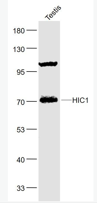 Anti-HIC1 antibody-肿瘤异常甲基化蛋白1抗体
