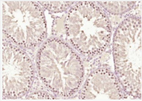 Anti-ZNF575 antibody-锌指蛋白575抗体