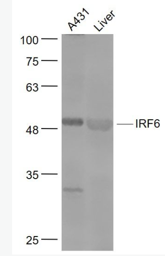 Anti-IRF6 antibody-干扰素调节因子6抗体