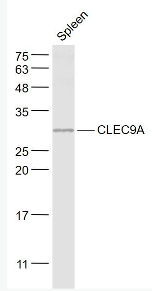 Anti-CLEC9A antibody-C型凝集素结构域家族9成员A抗体