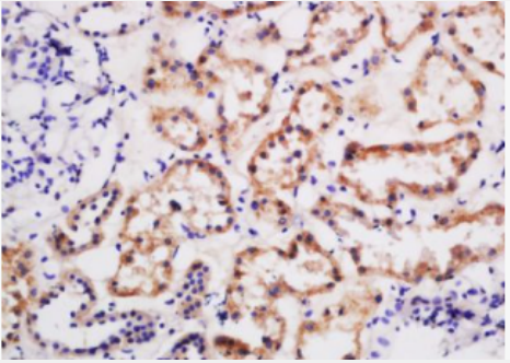 Anti-BTR1antibody-钙粘蛋白相关蛋白受体BTR1抗体