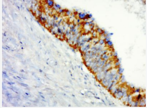 Anti-SHROOM1 antibody-SHROOM1蛋白抗体