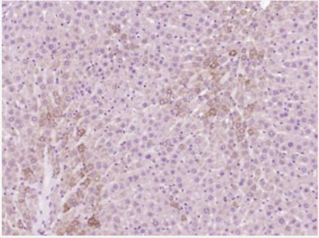 Anti-Phospho-Glycogen synthase 1 (Ser645) antibody-磷酸化葡萄糖合成酶1抗体