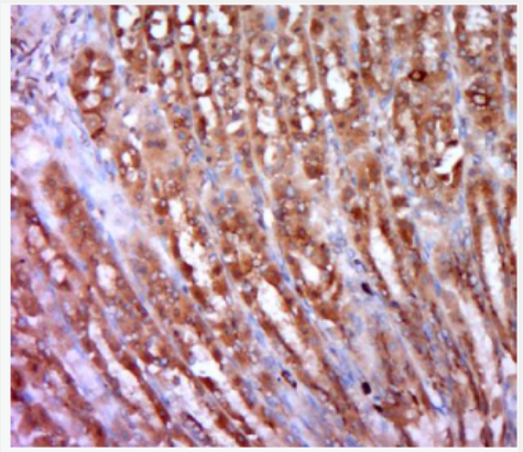 Anti-Smoothelin antibody-平滑肌蛋白抗体