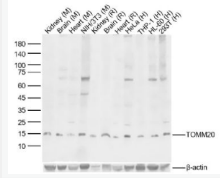 Anti-TOMM20 antibody-线粒体外膜受体Tom20抗体