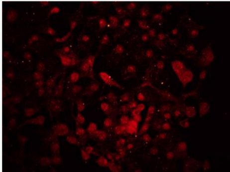 Anti-DACT1 antibody-肝癌新基因3蛋白抗体