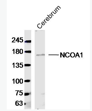 Anti-NCOA1/KAT13A antibody-核受体共激活剂1抗体