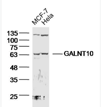 Anti-GALNT10 antibody-多肽N-乙酰氨基半乳糖转移酶10抗体