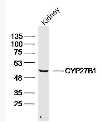 Anti-CYP27B1 antibody-细胞色素P450 27B1抗体