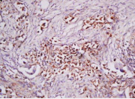 Anti-Neuropilin 2/NRP2 antibody-神经纤毛蛋白2抗体