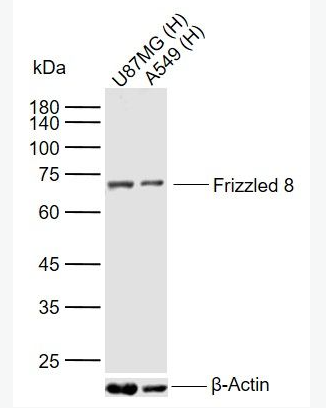 Anti-Frizzled 8antibody-卷曲蛋白8抗体