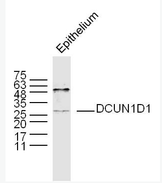 Anti-DCUN1D1 antibody-鳞状细胞癌相关蛋白抗体
