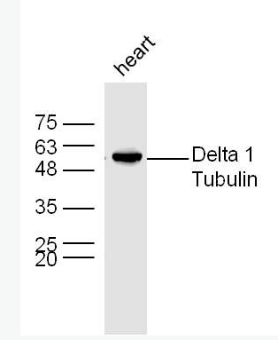 Anti-Delta 1 Tubulin antibody-微管蛋白δ1/δ Tubulin抗体