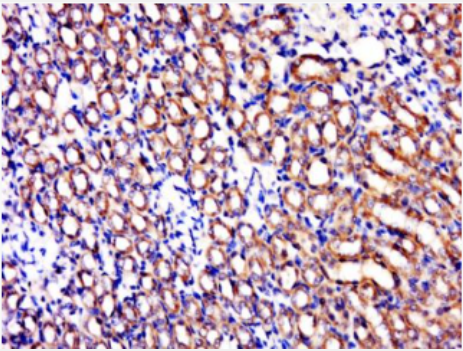 Anti-C1orf69 antibody-1号染色体开放阅读框69抗体