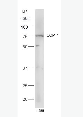 Anti-COMP antibody-软骨寡聚基质蛋白抗体