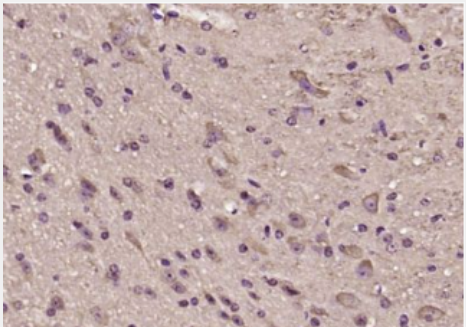 Anti-phospho-alpha B Crystallin (Ser19) antibody-磷酸化热休克蛋白β5/α晶状体球蛋白B/αB-crystallin抗体