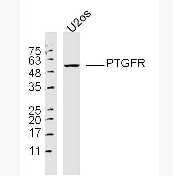 Anti-PTGFR antibody-前列腺素F2a受体抗体PGF2αR