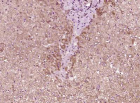 Anti-IL-9 antibody-白介素9抗体