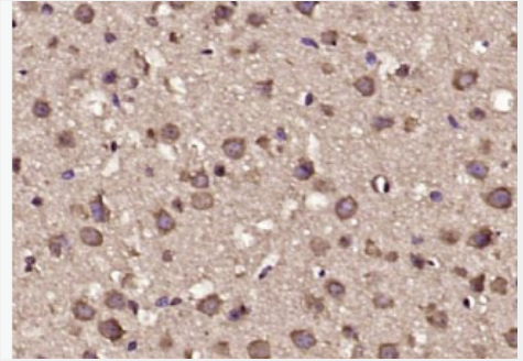 Anti-FOXK1 antibody-FOXK1蛋白抗体