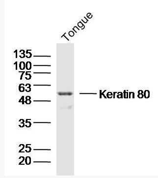 Anti-Keratin 80 antibody-细胞角蛋白80抗体