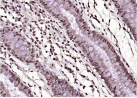 Anti-KLF12 antibody-锌指转录抑制因子KLF12抗体