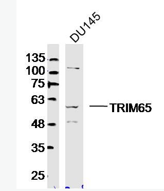 Anti-TRIM65 antibody-TRIM65蛋白抗体