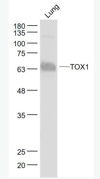 Anti-TOX1 antibody-胸腺高迁移率族蛋白TOX抗体