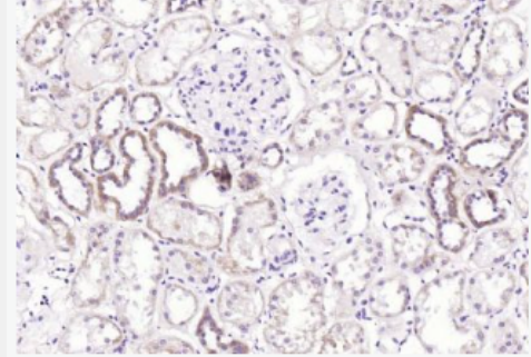 Anti-ATG14 antibody-自噬相关蛋白14抗体