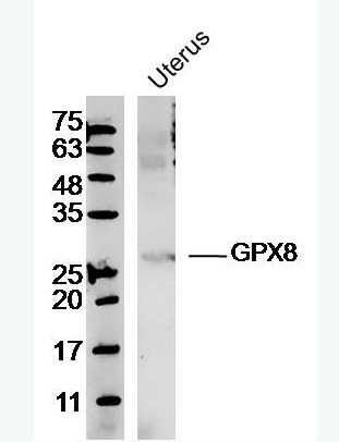 Anti-GPX8 antibody-谷胱甘肽过氧化物酶8抗体