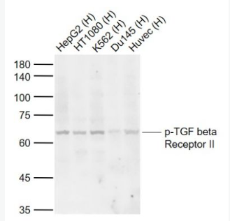 Anti-phospho-TGF beta Receptor II (Tyr259) antibody-磷酸化转移生长因子β受体2抗体