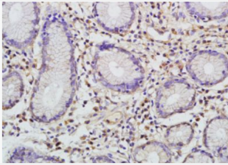 Anti-I-309/CCL1 antibody-嗜酸粒细胞趋化蛋白CCL1抗体