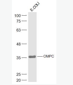 Anti-OMPC antibody-大肠杆菌外膜孔道蛋白C抗体