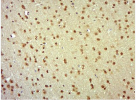 Anti-PKN1 antibody-蛋白激酶C相关激酶1抗体