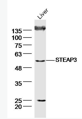 Anti-STEAP3 antibody-前列腺跨膜上皮3抗原抗体