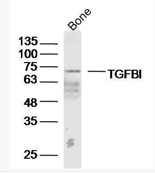 Anti-TGFBI antibody-角膜上皮蛋白TGFBI抗体