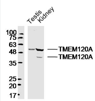 Anti-TMEM120A antibody-跨膜蛋白120A抗体