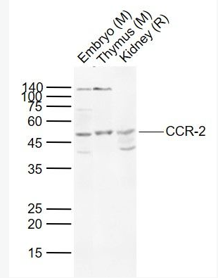 Anti-CCR-2 antibody-细胞表面趋化因子受体2抗体