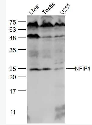 Anti-NFIP1 antibody-乳腺癌相关蛋白SGA 1M抗体