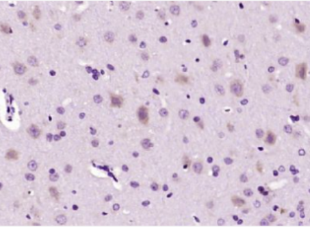 Anti-ACTG1 antibody-肌动蛋白γ1抗体