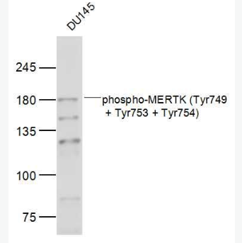 Anti-phospho-MERTK (Tyr749 + Tyr753 + Tyr754) antibody-磷酸化c-mer原癌基因酪氨酸激酶抗体