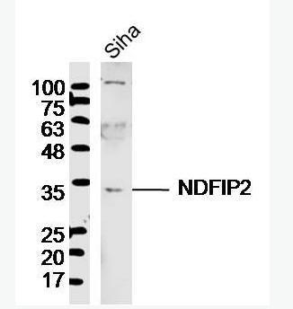 Anti-NDFIP2 antibody-NDFIP2抗体