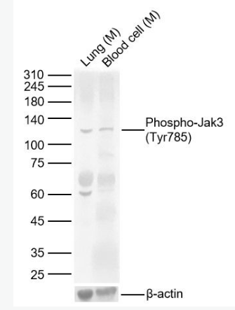 Anti-Phospho-Jak3 (Tyr785) antibody-磷酸化蛋白酪氨酸激酶JAK-3抗体