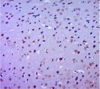 Anti-Cyclin D1 antibody-周期素D1抗体.