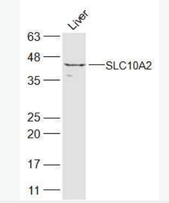 Anti-SLC10A2  antibody-顶膜钠依赖性胆盐转运体蛋白抗体