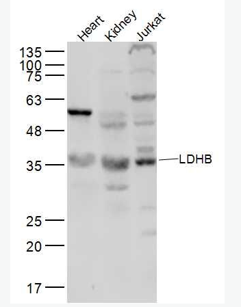 Anti-LDHB antibody-乳酸脱氢酶抗体