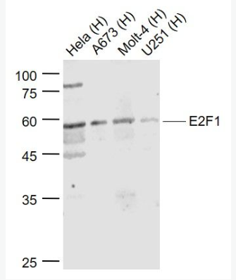 Anti-E2F1 antibody-转录因子E2F-1抗体