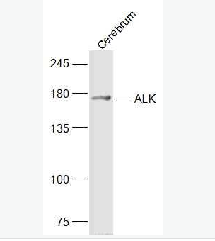 Anti-ALK antibody-间变型淋巴瘤激酶抗体