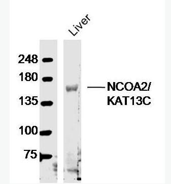 Anti-NCOA2/KAT13C  antibody-类固醇受体激活蛋白2抗体