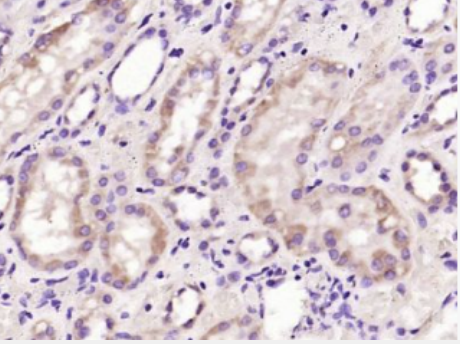 AntiVEGF165 antibody-血管内皮生长因子单克隆抗体